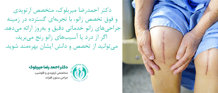 جراحی زانو توسط دکتر احمدرضا میربلوک جراحی زانو توسط دکتر احمدرضا میربلوک