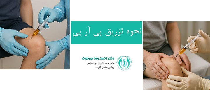 نحوه تزریق پی آر پی