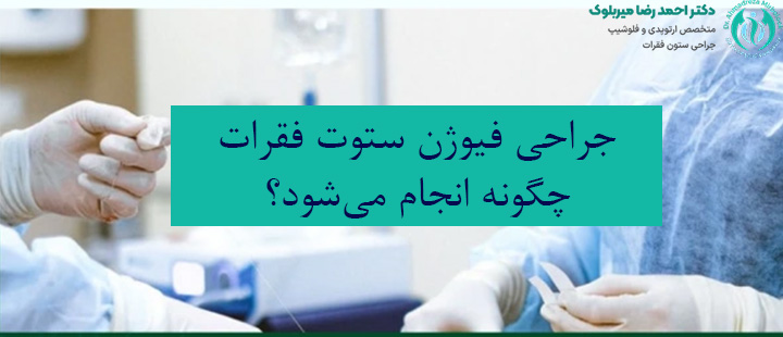 جراحی فیوژن ستون فقرات چگونه انجام میشود؟