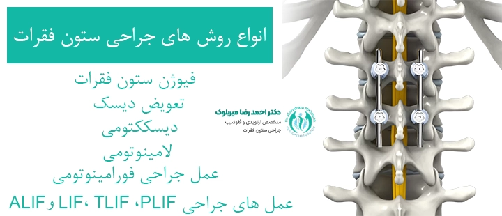 انواع روش های جراحی ستون فقرات
