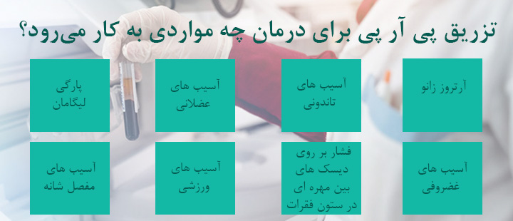 موارد استفاده از پی آر پی موارد استفاده از پی آر پی