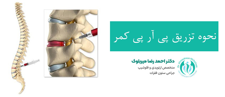 نحوه تزریق پی آر پی کمر نحوه تزریق پی آر پی کمر