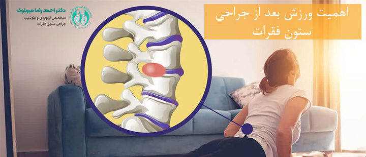 اهمیت ورزش بعد از جراحی ستون فقرات