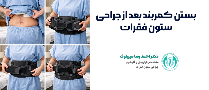 اهمیت بستن کمربند بعد از جراحی ستون فقرات