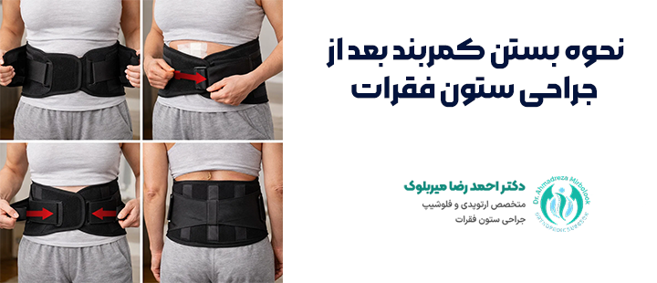 نحوه بستن کمربند بعد از جراحی ستون فقرات