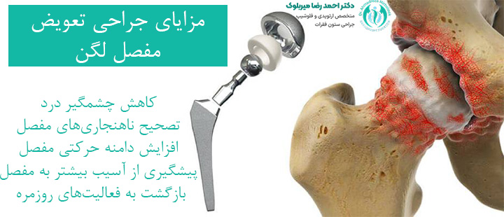 مزایای جراحی تعویض مفصل لگن مزایای جراحی تعویض مفصل لگن