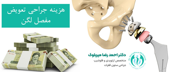 هزینه تعویض مفصل لگن هزینه تعویض مفصل لگن
