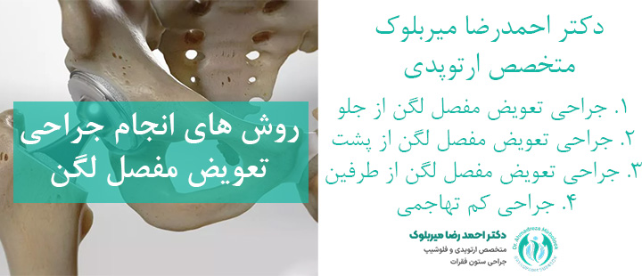 روش های جراحی تعویض مفصل لگن روش های جراحی تعویض مفصل لگن