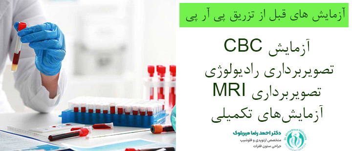 آزمایش های قبل از پی آر پی