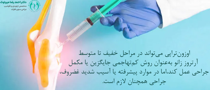 اوزونتراپی میتواند جایگزین جراحی زانو شود؟