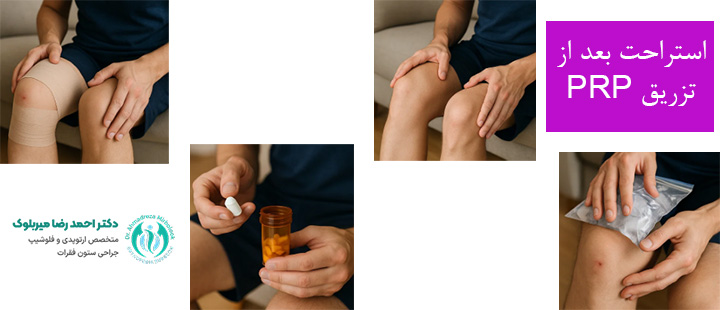 استراحت بعد از تزریق پی آر پی استراحت بعد از تزریق پی آر پی