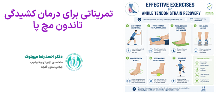 تمریناتی برای درمان کشیدگی تاندون مچ پا