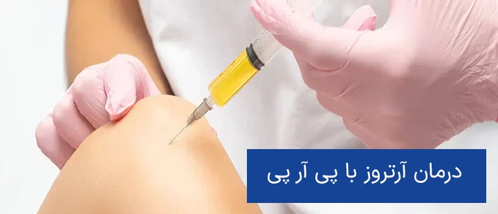 درمان آرتروز با پی آر پی درمان آرتروز با پی آر پی