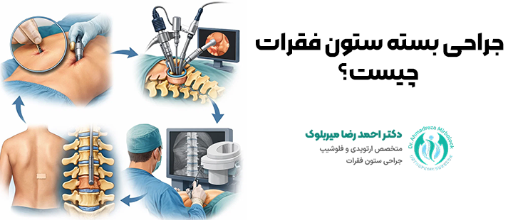 جراحی بسته ستون فقرات چیست؟ جراحی بسته ستون فقرات چیست؟