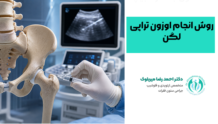 روش انجام اوزون تراپی لگن