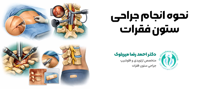نحوه انجام جراحی ستون فقرات