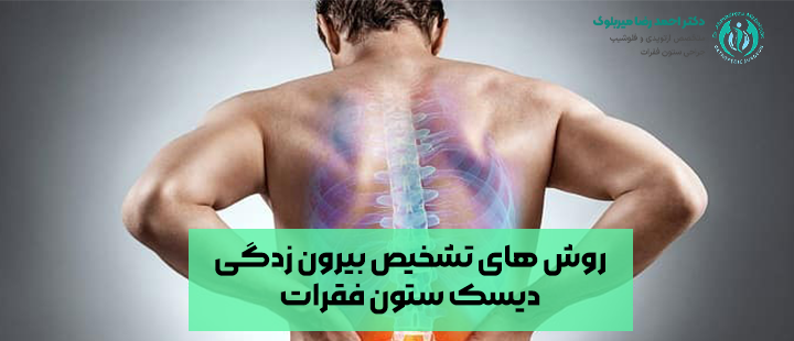 روش های تشخیص بیرون زدگی دیسک ستون فقرات