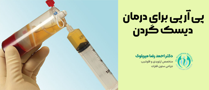 پی آر پی برای درمان دیسک گردن