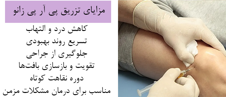 مزایای پی آر پی زانو مزایای پی آر پی زانو