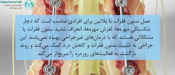 افراد مناسب جراحی ستون فقرات با پلاتین افراد مناسب جراحی ستون فقرات با پلاتین