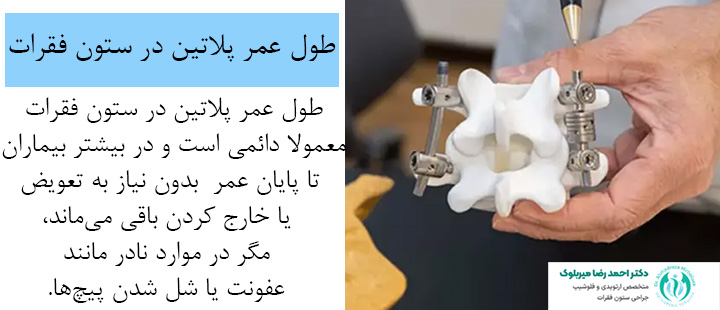 طول عمر پلاتین در ستون فقرات طول عمر پلاتین در ستون فقرات