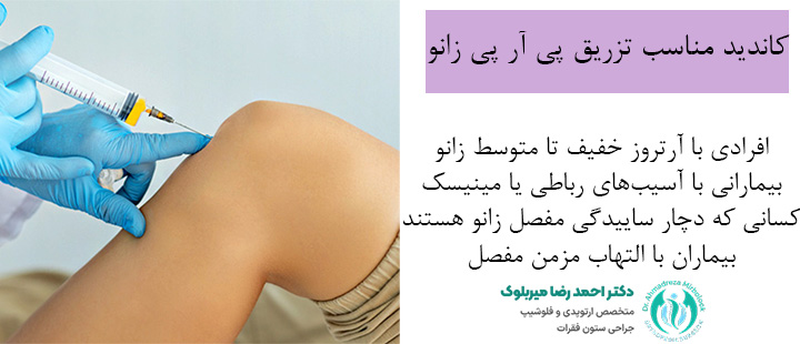 کاندید مناسب تزریق پی آر پی زانو