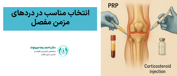 انتخاب مناسب در دردهای مزمن مفصل