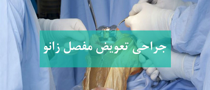 جراحی تعویض مفصل زانو جراحی تعویض مفصل زانو