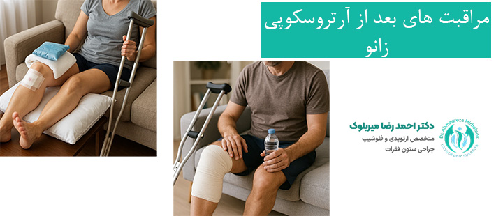 مراقبت های بعد از آرتروسکوپی زانو مراقبت های بعد از آرتروسکوپی زانو