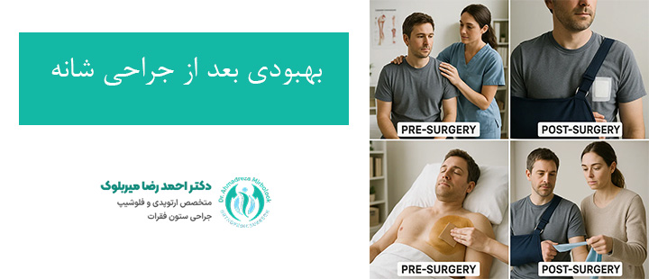 بهبودی بعد از جراحی شانه بهبودی بعد از جراحی شانه
