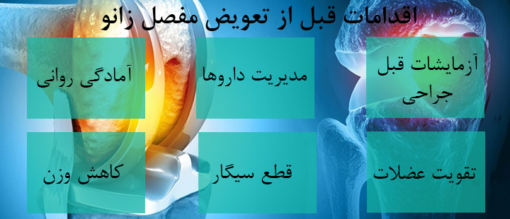 اقدامات قبل از تعویض مفصل زانو اقدامات قبل از تعویض مفصل زانو