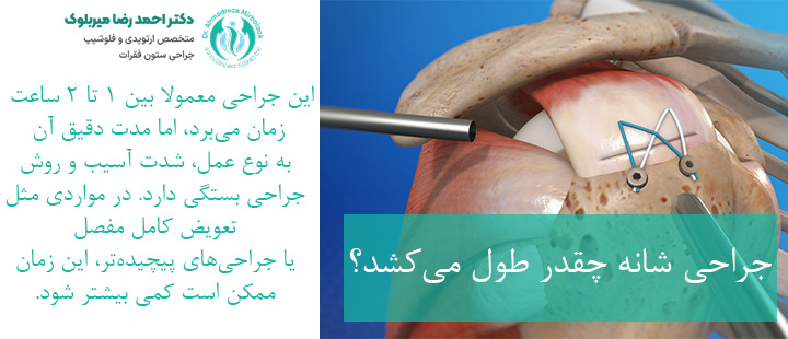 مدت زمان انجام جراحی شانه