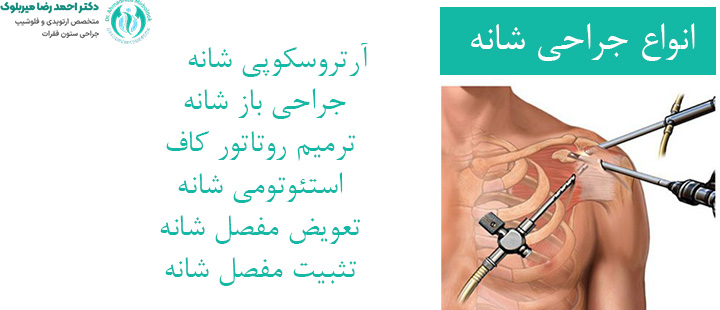 انواع جراحی شانه انواع جراحی شانه