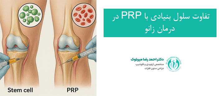تفاوت سلول بنیادی با PRP در درمان زانو