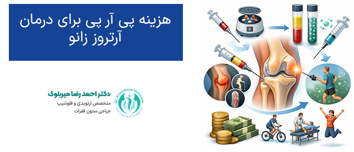 پی آر پی برای درمان آرتروز زانو