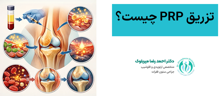 تزریق پی آر پی