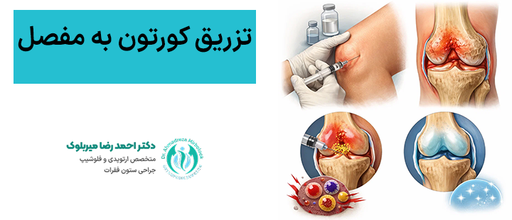 تزریق کورتون به مفصل