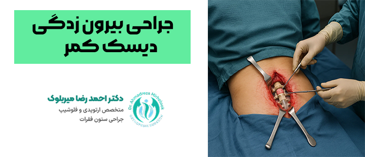 جراحی بیرون زدگی دیسک کمر جراحی بیرون زدگی دیسک کمر