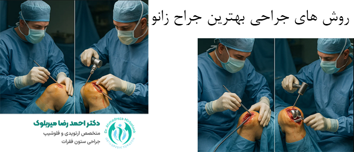 روش های جراحی بهترین جراح زانو