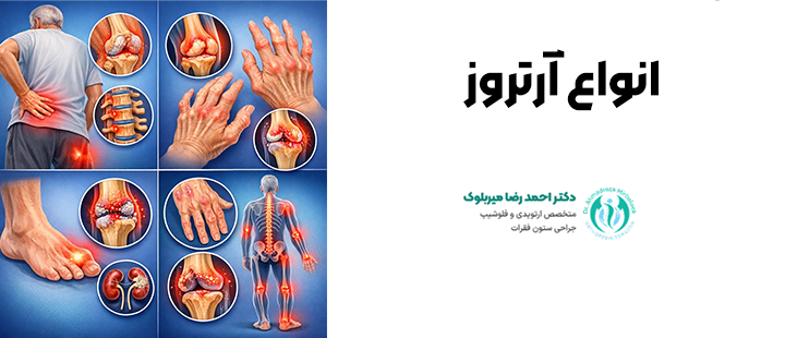 انواع آرتروز
