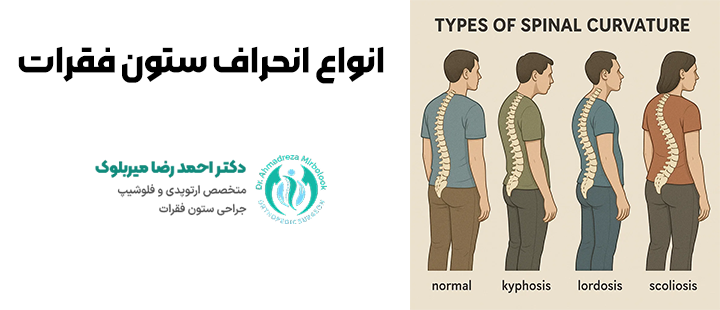 انواع انحراف ستون فقرات
