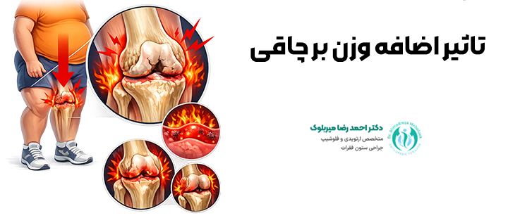 تاثیر اضافه وزن بر چاقی