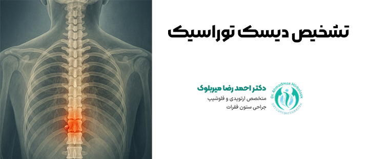 تشخیص دیسک توراسیک