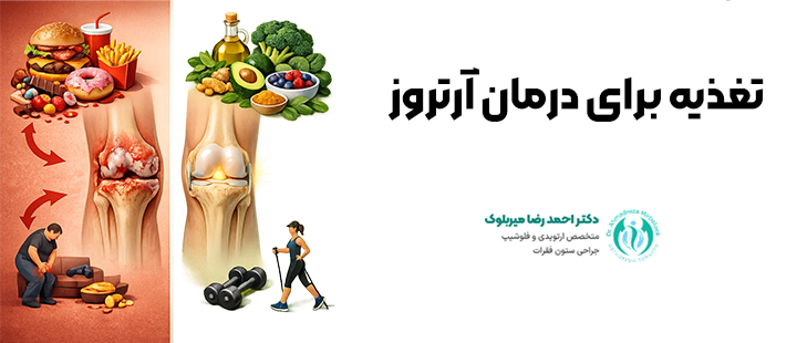 تغذیه برای درمان آرتروز