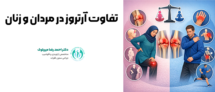 تفاوت آرتروز در مردان و زنان