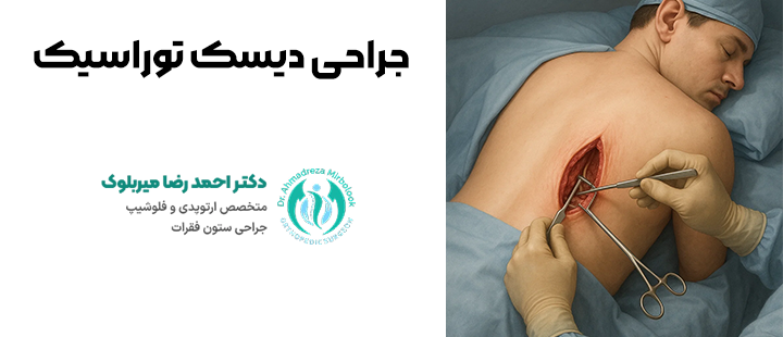 جراحی دیسک توراسیک