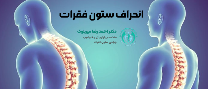 درباره انحراف ستون فقرات