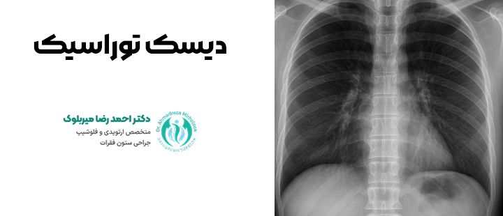 دیسک توراسیک