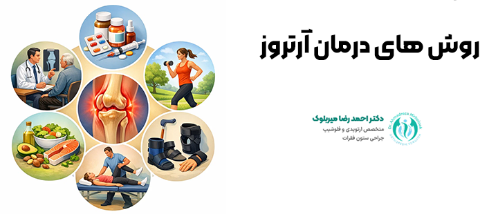 روش های درمان آرتروز