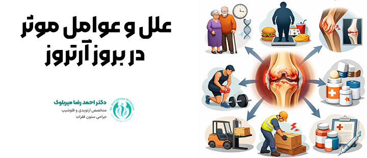 علل و عوامل موثر در بروز آرتروز